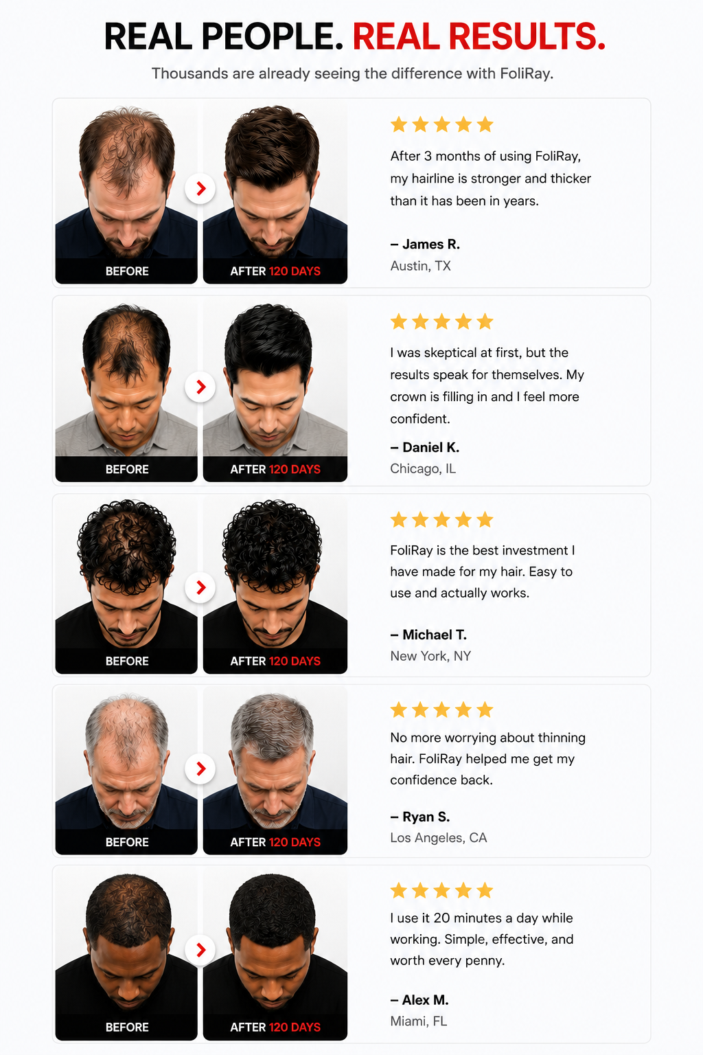 Real People. Real Results. Five FoliRay customer testimonials with before and after hair results.